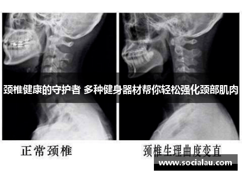 颈椎健康的守护者 多种健身器材帮你轻松强化颈部肌肉
